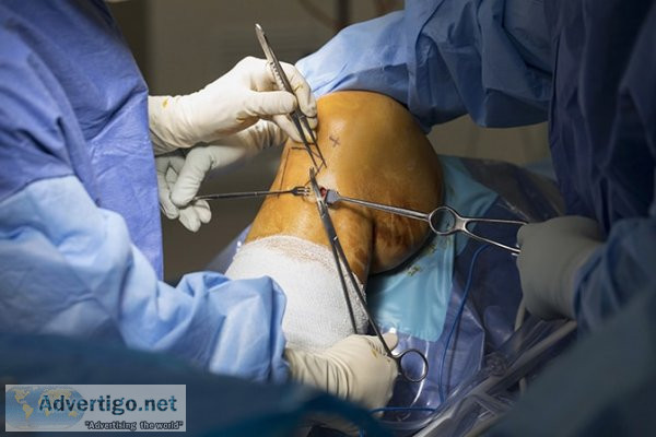Acl ligament surgery in delhi