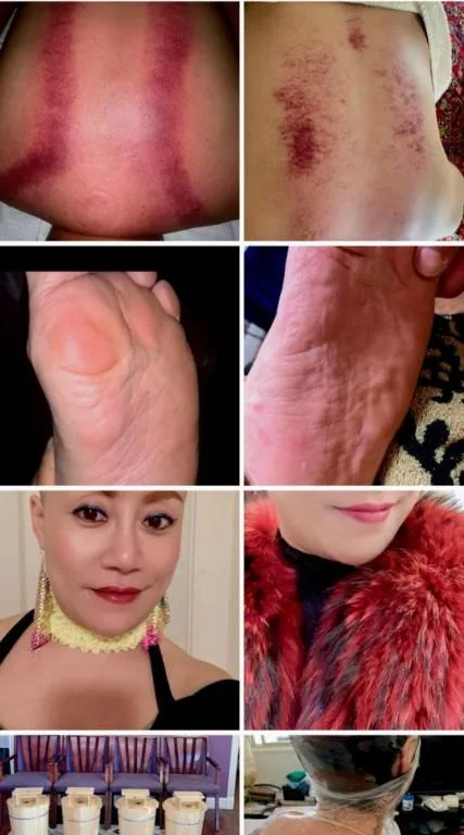 Herbal massage pain management and facial