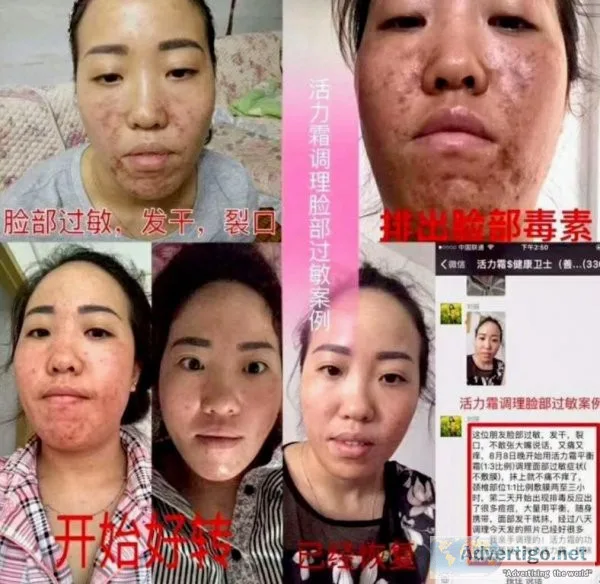 Herbal massage pain management and facial