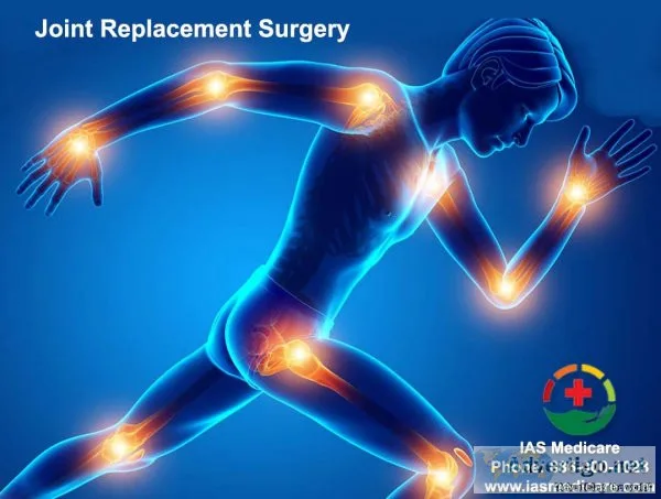 Best joint replacement surgery hospital in gurugram