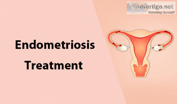 Best endometriosis doctor in jaipur
