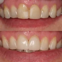 Find the top-rated dentist in langley