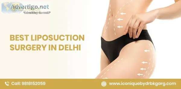 Best liposuction surgery in delhi | dr bk garg