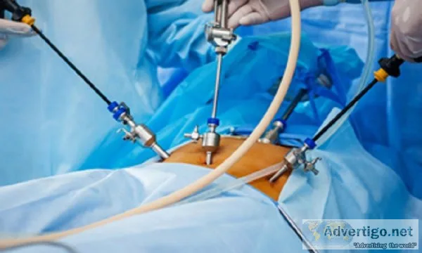Laparoscopic-surgeon-in-jaipur