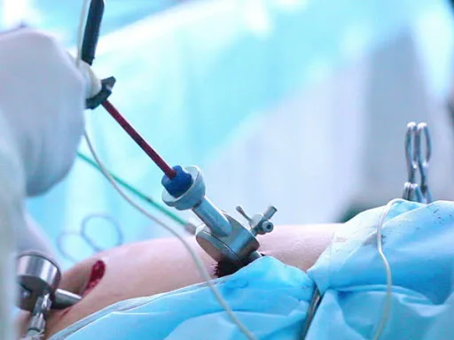Laparoscopic-surgeon-in-jaipur