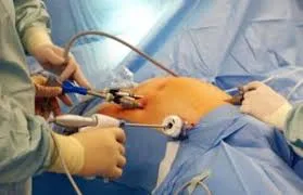 Laparoscopic-surgeon-in-jaipur