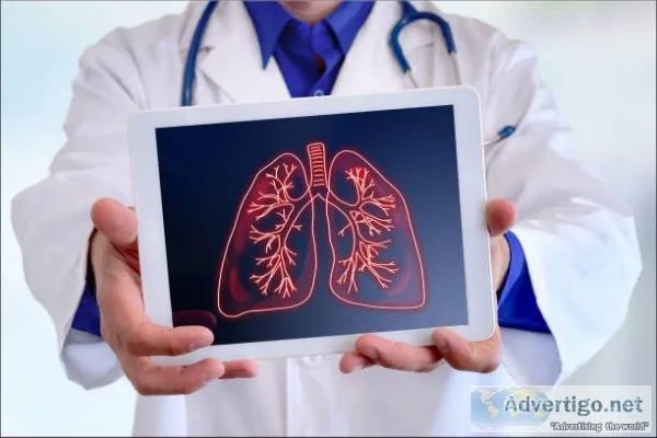 Best pulmonologists in hyderabad
