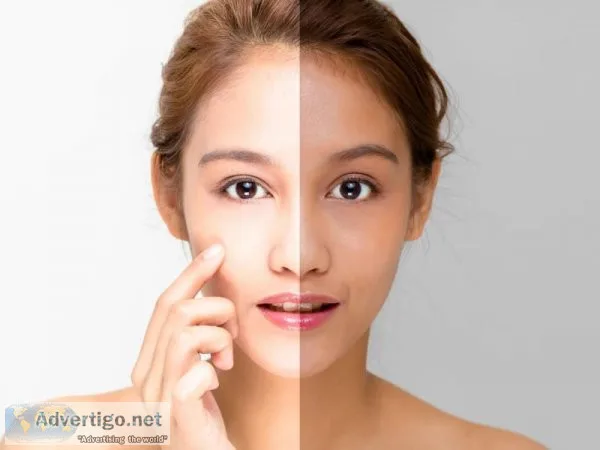 Skin whitening treatment cost in delhi- dr syed hussain