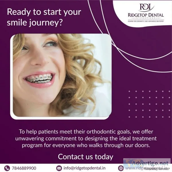 Dentures in bangalore