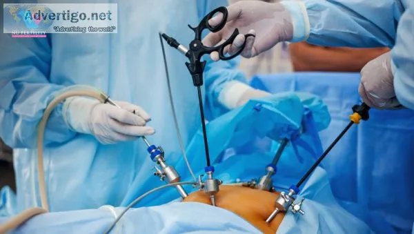 Ovarian cancer surgeon in delhi