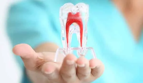 Best root canal treatment and specialist near me
