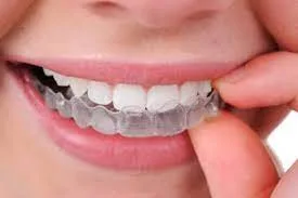 Invisible braces in mumbai