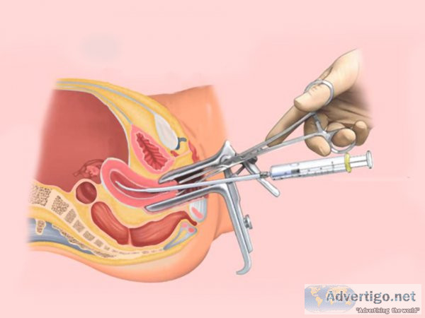 Test tube baby center in rajasthan