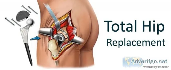 Hip replacement surgeons in kothrud | best hip replacement docto