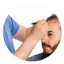 Find the hair specialist in gurgaon