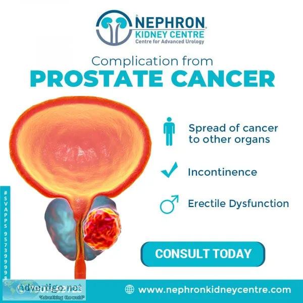 Best urologist in hanamkonda