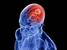 Best head cancer doctor in jaipur