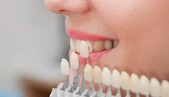 Teeth whitening dentist in noida vaishali call 9650780998