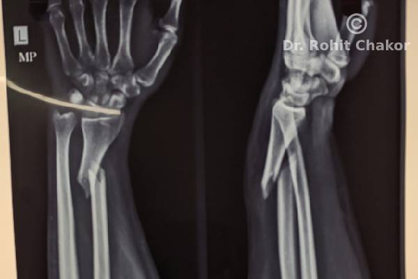 Orthopedic doctor in kharadi | orthopedic surgeon in kharadi | d