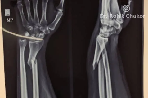 Orthopedic doctor in kharadi | orthopedic surgeon in kharadi | d