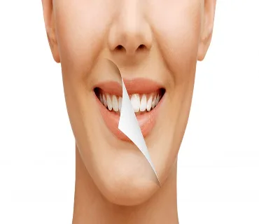 Smile designing in pune | cosmetic dentistry in shivaji nagar pu
