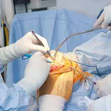Best arthroscopy surgery in delhi