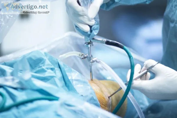 Best arthroscopy surgery in delhi