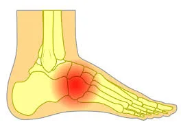 Leg and foot injury treatment in bihar