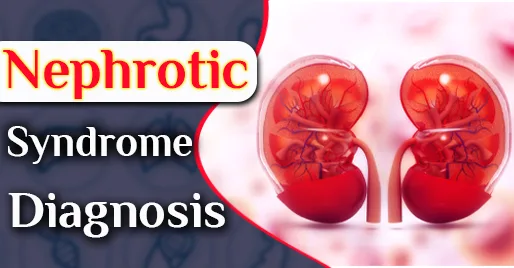 Nephrotic syndrome ayurvedic treatment