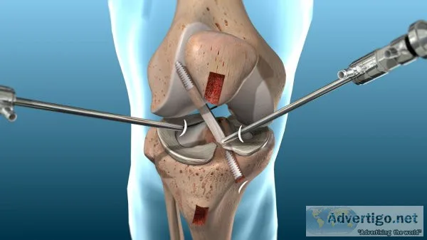 Acl ligament surgery in haryana