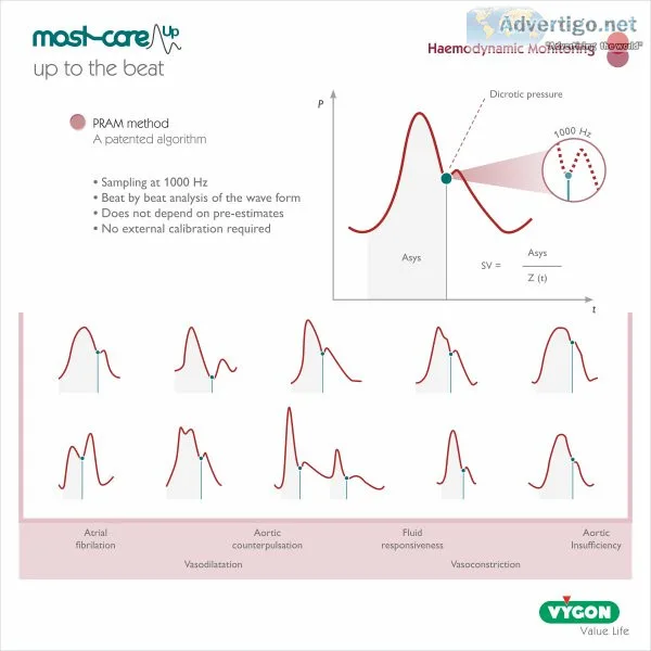 Advanced haemodynamic monitoring