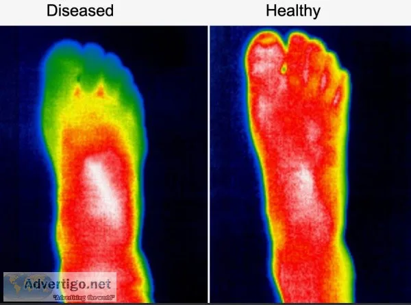 Need Neuropathy nerve damage, Wound, Spine Care?