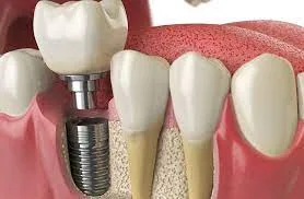 Dental clinic in gurgaon