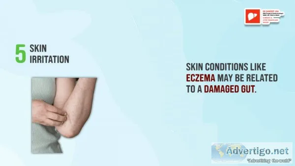 Best liver doctor in delhi
