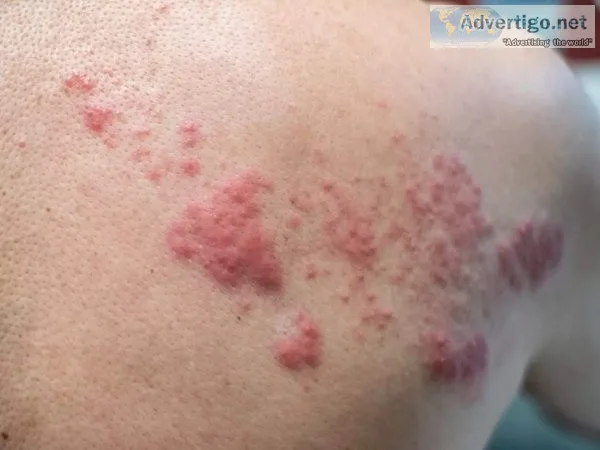 Allergy care doctors in jaipur