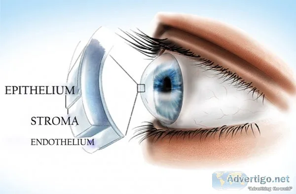 Eye specialist clinic in delhi