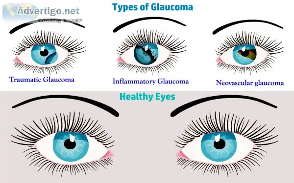 Eye specialist clinic in delhi