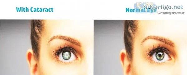 Eye specialist clinic in delhi