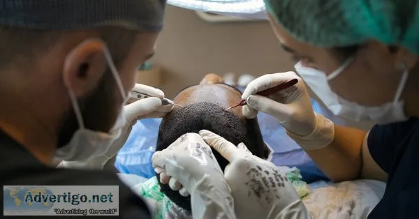 Hair transplant cost in delhi | dr a s clinic