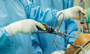 Arthroscopy surgery in nepal