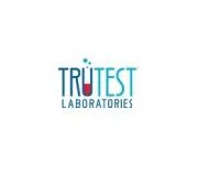 Blood test lab in chandigarh