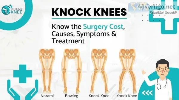 Knock knee surgery cost in india