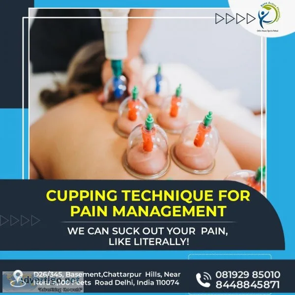 Cupping in physiotherapy
