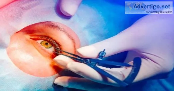Smile eye surgery cost in india at best hospitals