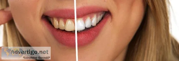 Do This 60 Seconds Dental Trick Before Going to Bed Tonight