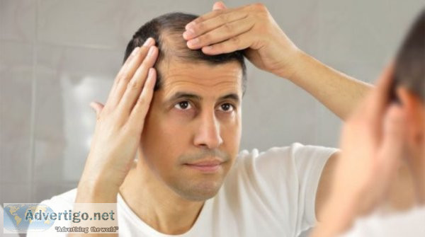 Best hair loss treatment in delhi