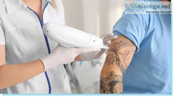 Tattoo removal in dubai