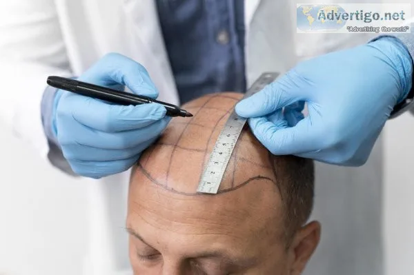 Hair fall treatment in raipur