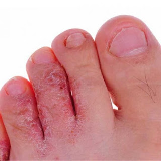 Why take care of your feet?
