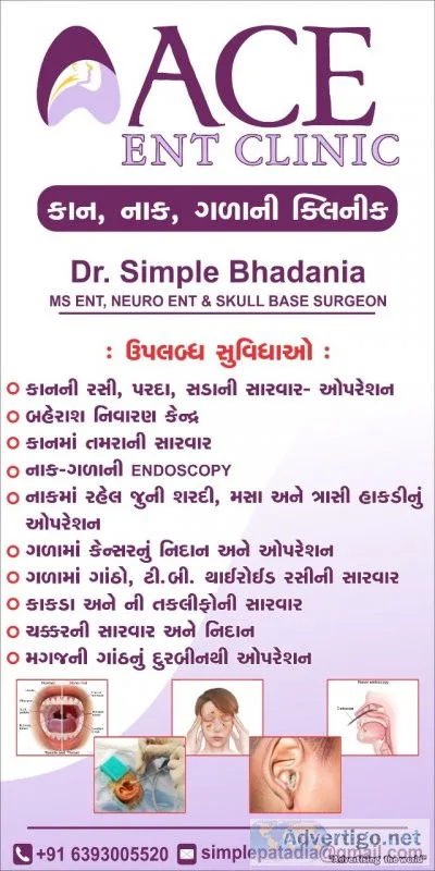 Ent doctor in ahmedabad